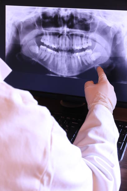 Best After-Hours Dental Trauma Care in Matteson, IL