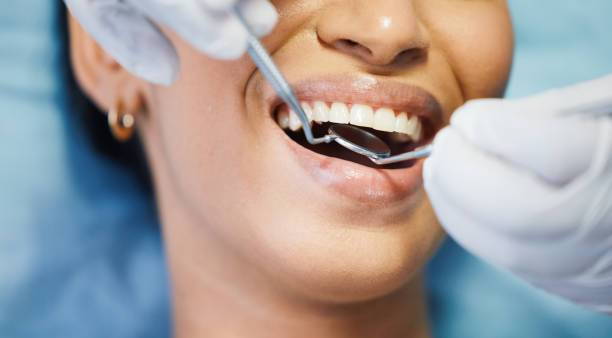 Best Emergency Treatment for Dental Infections or Abscesses in Matteson, IL
