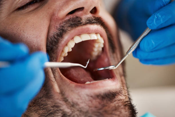 Best Emergency Treatment for Dental Infections or Abscesses in Matteson, IL