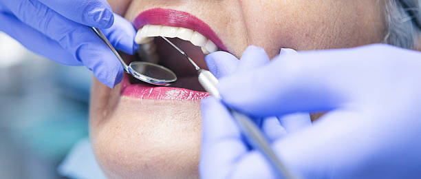 Best Emergency Tooth Extraction in Matteson, IL